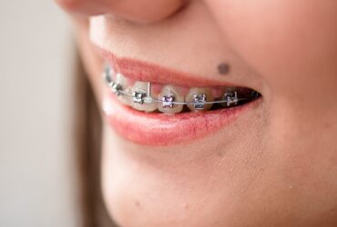 Achieve Your Perfect Smile with Expert Cosmetic Dentistry in Amman