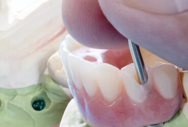 Achieve Your Perfect Smile with Expert Cosmetic Dentistry in Amman